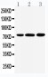 Anti-Beta Glucuronidase(Gusb) Antibody